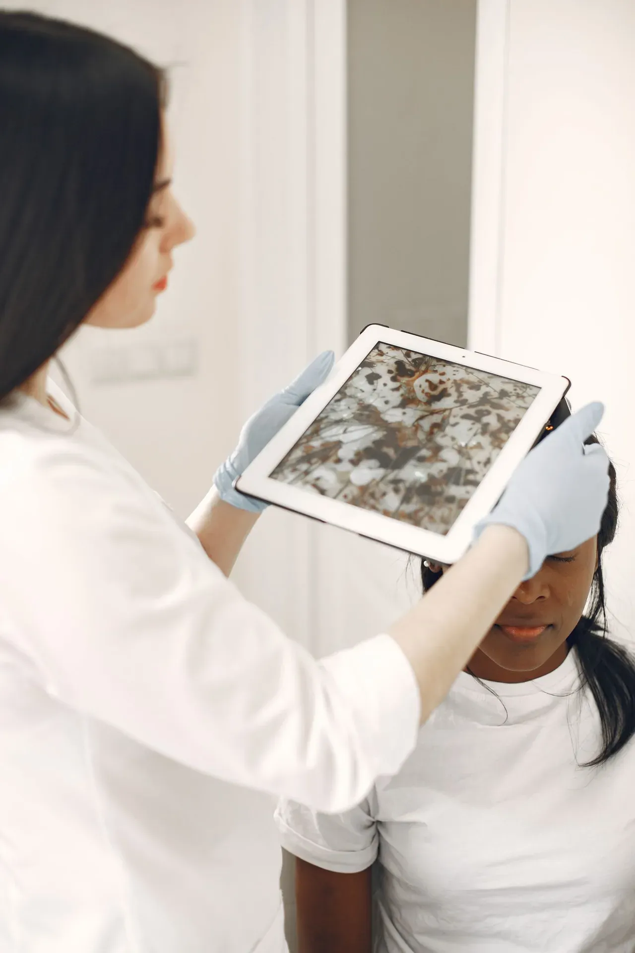 Dermatólogo examinando la piel de un paciente antes de aplicar crioterapia para una verruga